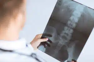 طبيب يفحص الأشعة السينية
