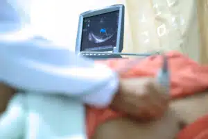 أشعة الايكو على القلب - معلومات ونصائح
